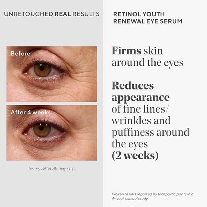Murad Bright Eyed & Sculpted Body Combo - Retinol Eye Serum & Body Treatment Set for Brightening & Cellulite Reduction