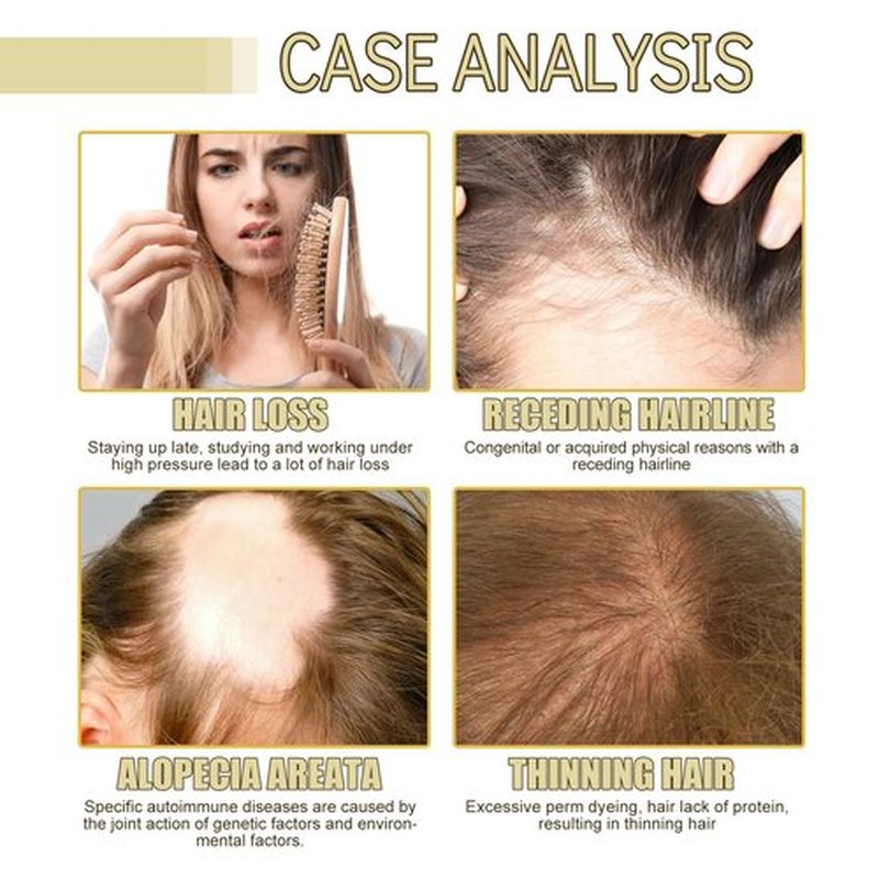 180 ML EELHOE Hair Growth Oil, Natural Rosemary Hair Growth Oil for Dry Damaged Hair and Growth Thin Hair. (3Pcs)
