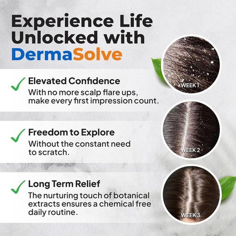 Dermasolve Scalp Oil - Flaky Scalp Relief for Psoriasis & Dandruff | 4 oz, Dermatologist Approved