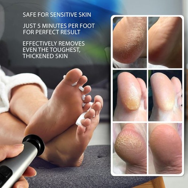 Spargos Electric Foot Callus Remover – Rechargeable Metal Foot File for Dead Skin & Cracked Heels – 9 Speed Professional Pedicure Tools with 60 Sanding Discs – Powerful Heel Scraper for Feet, Black