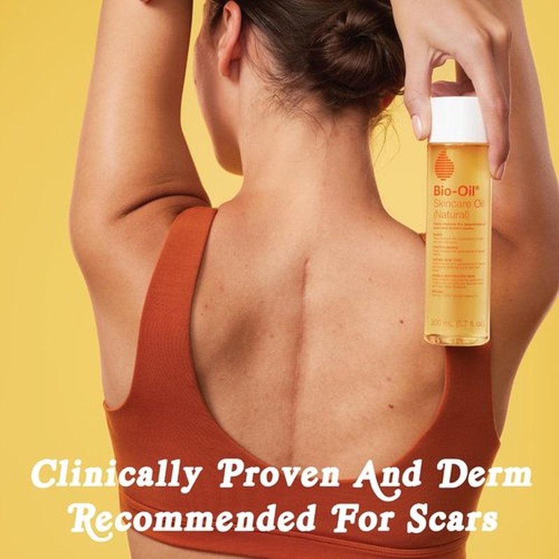 Bio-Oil Natural Skincare Oil - Serum for Scars & Stretch Marks | 6.7 Oz Moisturizer for All Skin Types