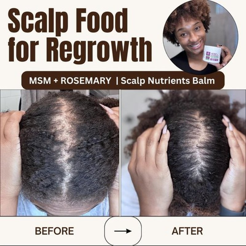 Qhemet Biologics MSM + Rosemary Scalp Nutrients Balm | Scalp Food for Hair Growth | MSM, Rosemary, Bhringraj, Castor Oil & Coconut Oil | For Dry Scalp, Thinning & Slow Growth | Vegan (4 oz)