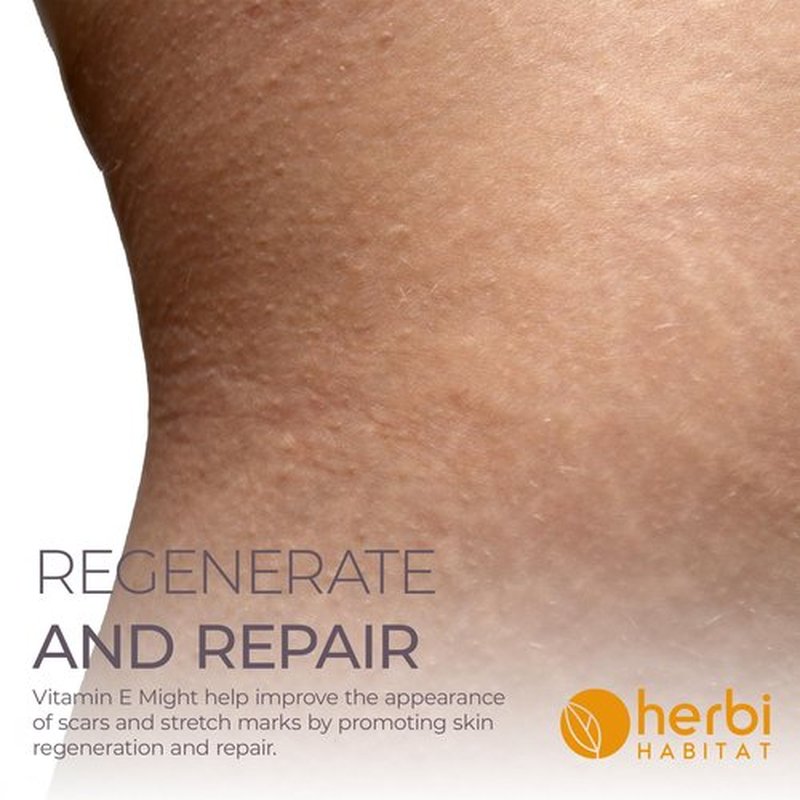 Herbi Habitat Vitamin E Oil 86,000 IU per bottle - Natural D-Alpha Tocopherol for Skin, Hair, Nails, Scars & Stretch Marks - Non-GMO & Vegan, 2 Fl oz
