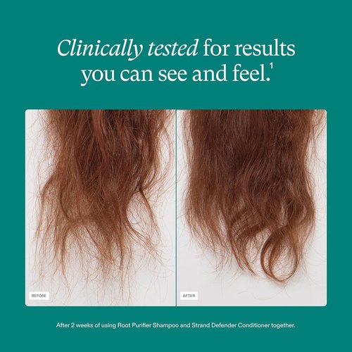 Nutrafol Conditioner - Physician-Formulated for Thinning Hair | Moisturizing & Color Safe, Lightweight Protection
