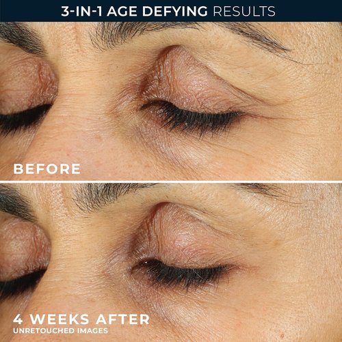RoC Retinol Correxion Under Eye Cream - Reduce Dark Circles & Puffiness | Anti-Aging Treatment, 0.5 oz