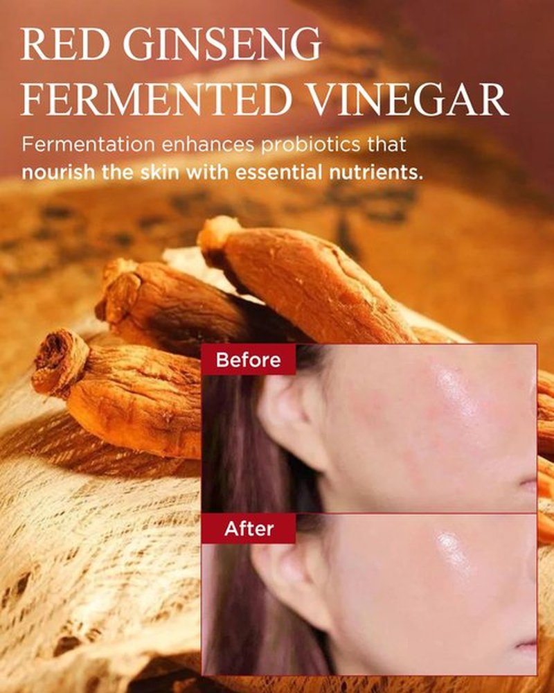 DANAHAN Bonyongo 6-Year Red Ginseng Vinegar Essence – Bouncy Concentrated Serum, Non-Sticky – pH Balancing Hydration & Glow, 8-Herb Complex, Revitalizing & Intensive for All Skin Types 1.5 fl.oz