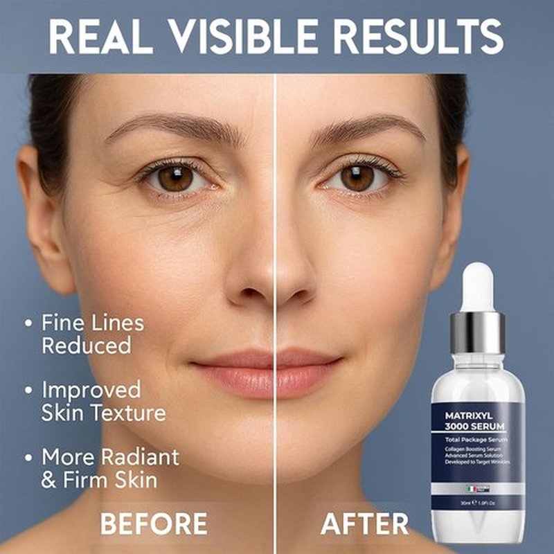 Matrixyl 3000 Total Package Serum - Anti-Wrinkle & Hydrating Formula with Hyaluronic Acid | 30ml