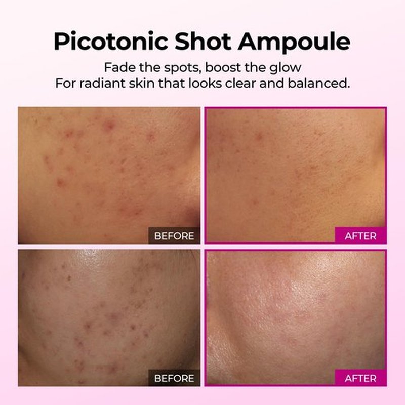 Dr.Melaxin Cemenrete Picotonic Shot Calcium Serum for Firming Density collagen serum Even Skin Tone & Skin Clarity Anti-aging Dark spot care 1.01 fl.oz.