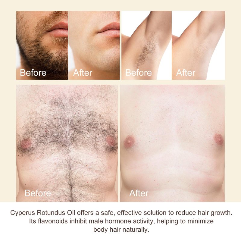 Nyloriaine Cyperus Rotundus Oil for Hair Removal 60ml, Natural Herbal Hair Care Oil for Post Hair Removal Use, Moisturizes & Soothes Skin, Helps Improve Skin Appearance, For All Skin Types