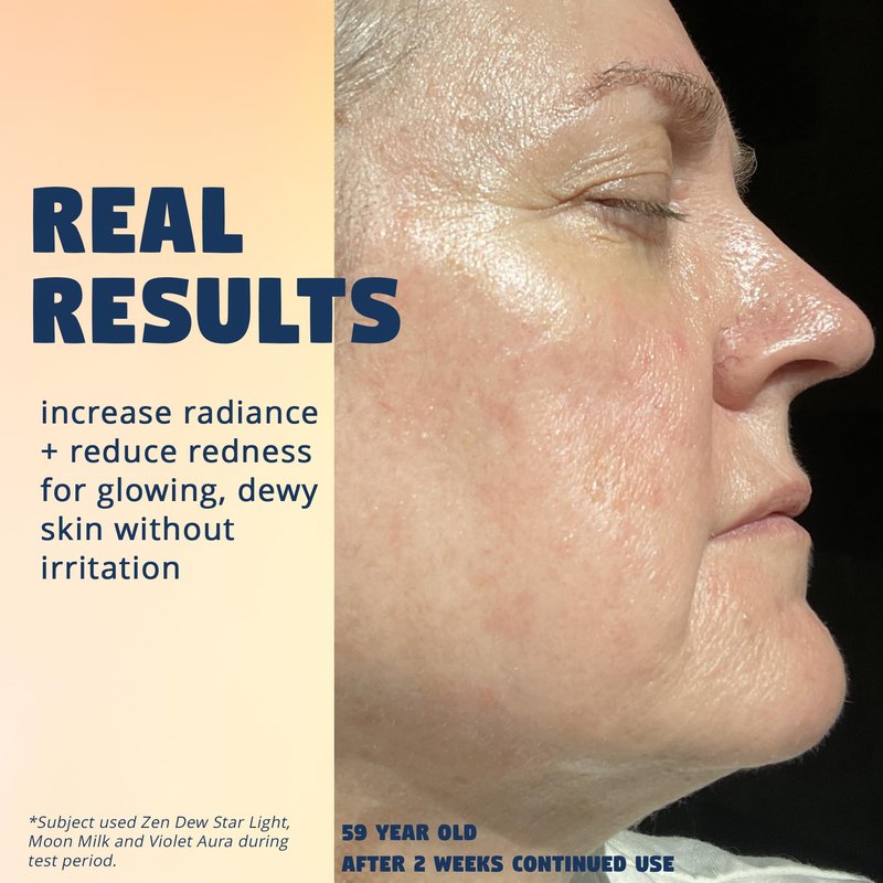 Zen Dew Violet Aura - 2% BHA Exfoliating Toner with Salicylic Acid for Sensitive Skin. Gentle, Hydrating Formula. 2% Niacinamide, Rice Extract & Azulene. Glass Skin, Smoother Texture & Barrier Support