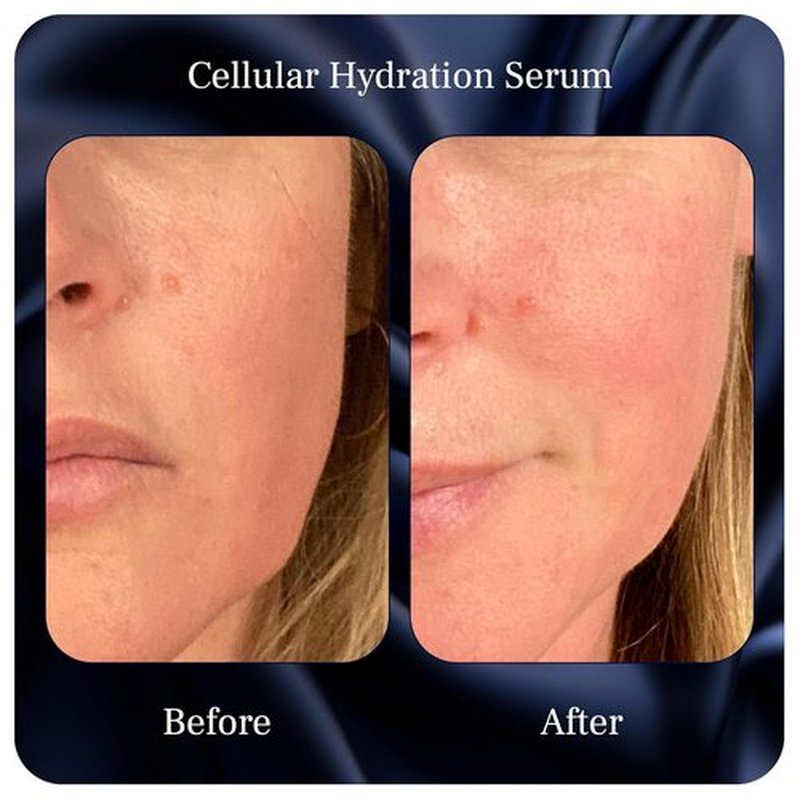 Cellular Hydration Serum - Hyaluronic Acid Alternative for Deep Hydration - 1 Fl Oz with Witch Hazel, Aloe & More