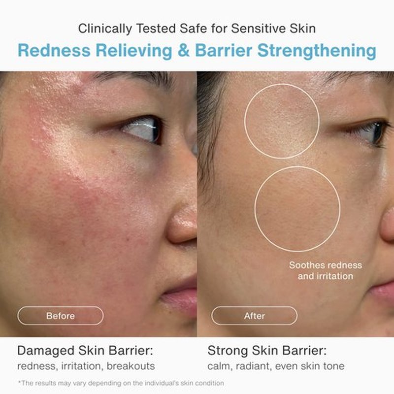 AROOM Barrier Repair Cream with Panthenol & Ceramide | Damaged Skin Restore and Deep Hydration | Non-Comedogenic, Fragrance Free, Korean Skincare | Chaga Comfort Cream, 60ml / 2.02 fl oz