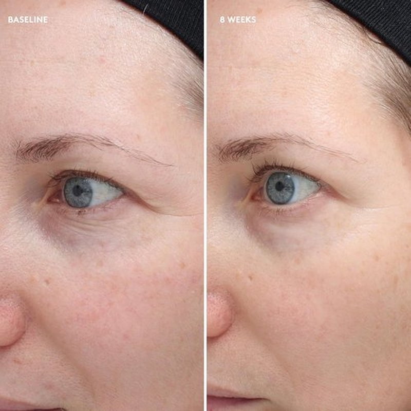 Colorescience Total Eye Firm & Repair Cream - Anti-Aging Formula | 0.6 Fl. Oz.