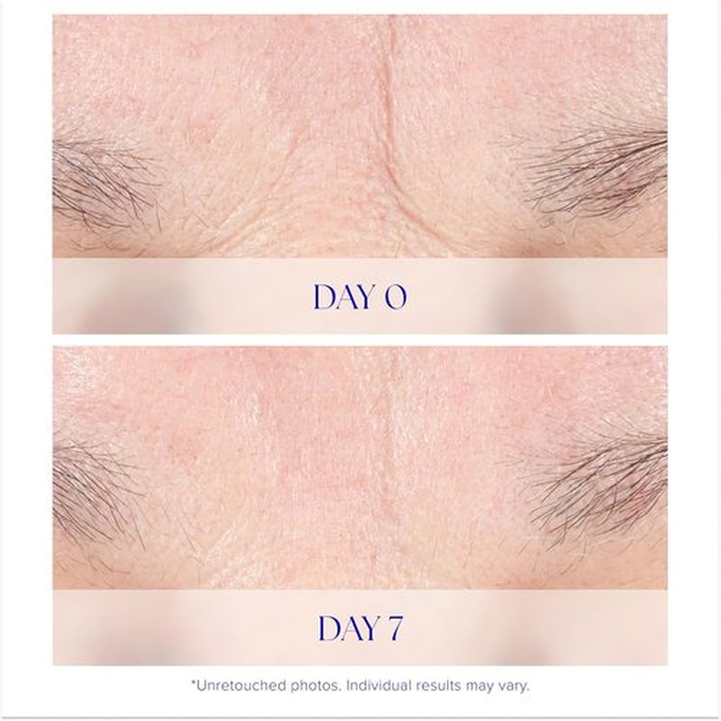 iS CLINICAL Youth Intensive Crème - Anti-Aging Firming Face Cream | Reduces Fine Lines & Wrinkles