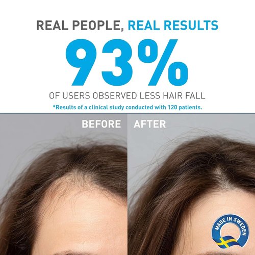 Bionnex Anti-Hair Loss Shampoo - Restores Hair Vitality & Boosts Growth | 10.14 fl. oz.