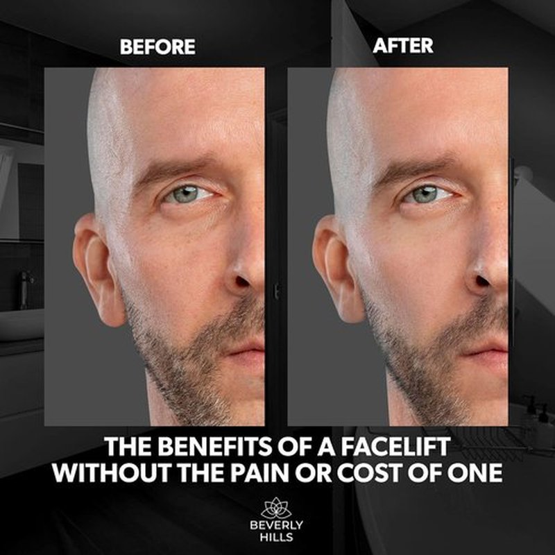 Beverly Hills Instant Facelift Eye Serum - Reduce Dark Circles & Puffiness | Anti-Wrinkle Treatment