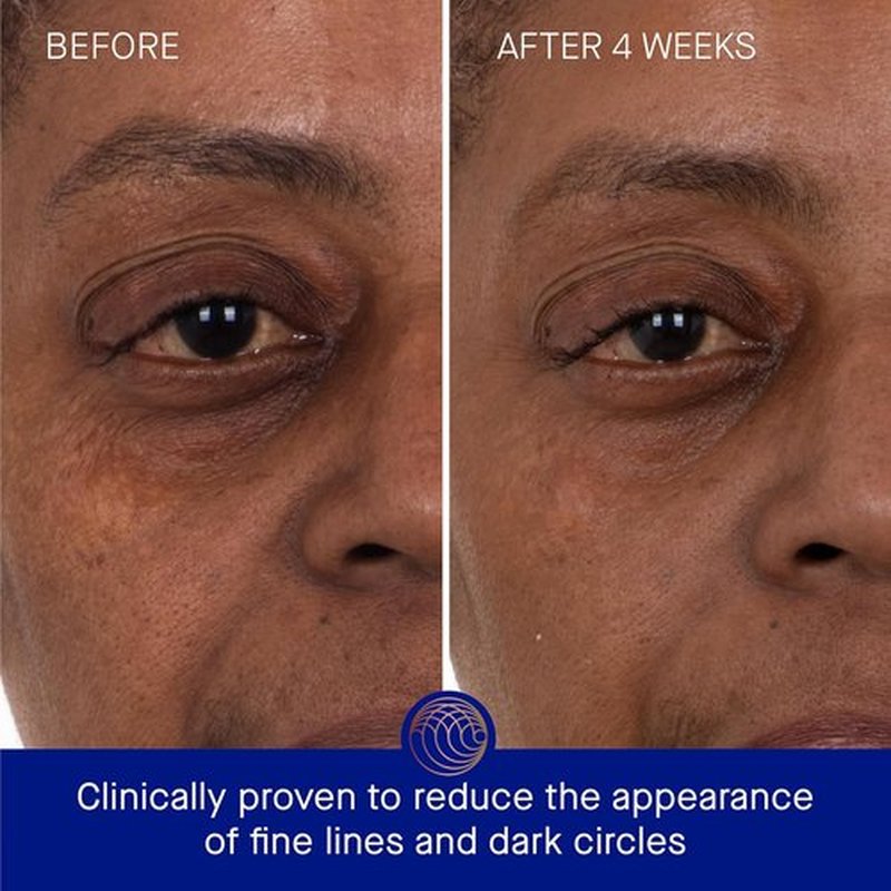Augustinus Bader Eye Patches - Luxury Hydrating Anti-Aging Treatment for Under Eyes - Reduces Puffiness & Brightens Dark Circles