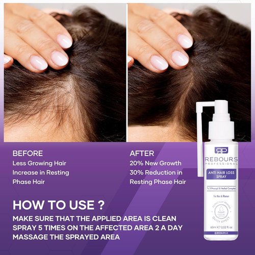 Hair Regrowth Treatment by Hair Regrowth | 5% Procapil Anti Hair Loss Spray for Stronger, Fuller Hair – Residue-Free Formula