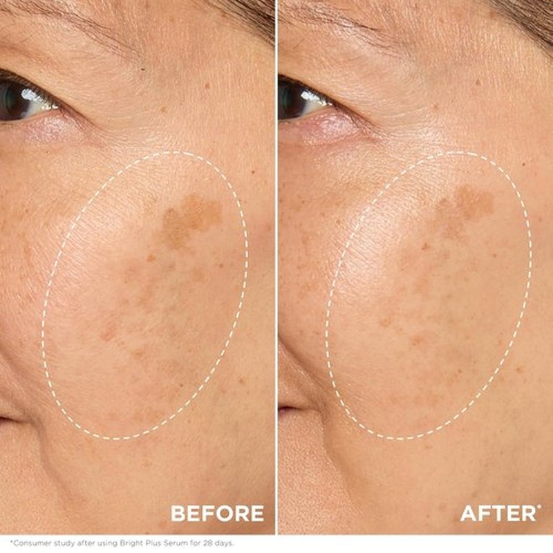 Clarins Bright Plus Serum - Brightens & Boosts Radiance | Evens Skin Tone & Targets Dark Spots | 1 Fl Oz