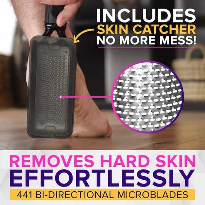 **NYK1 Megafile Foot Callus Remover - Rustproof XL Size with Skin Catcher for Wet & Dry Use**