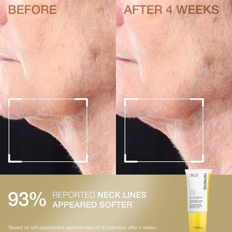 StriVectin Neck Cream & Serum Roller Set - Anti-Aging Formula for Smoother, Youthful Skin
