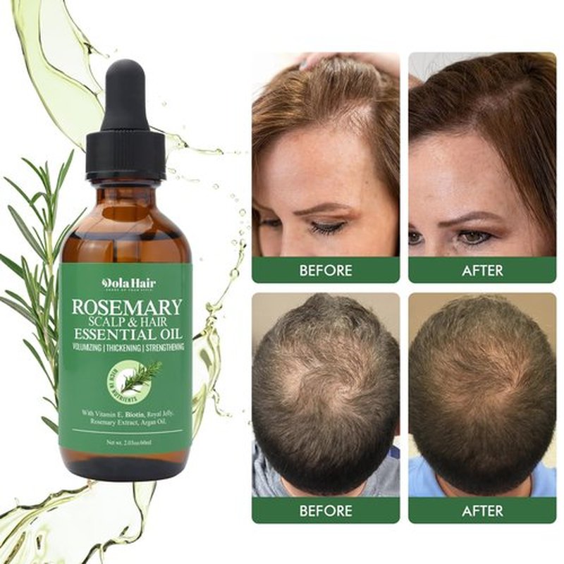 Dolahair Rosemary Hair Oil - Organic Essential for Hair Growth, Strengthens , Fights Dandruff & Prevents Greying, 2.03 Oz for Thin, Skin Healthy Scalp