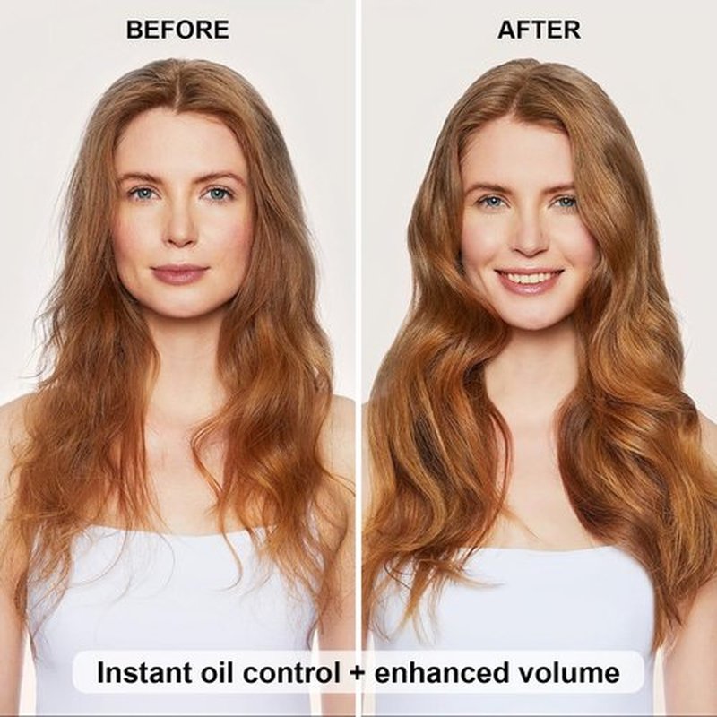 LADDYFOX 7.61Oz Hair Dry Shampoo Spray, Instantly Refreshes Hair No White Residue, Refresh Hair with Rice Starch - Absorbs Excess Oil, Oil Control and Volumizing Dry Shampoo for Women