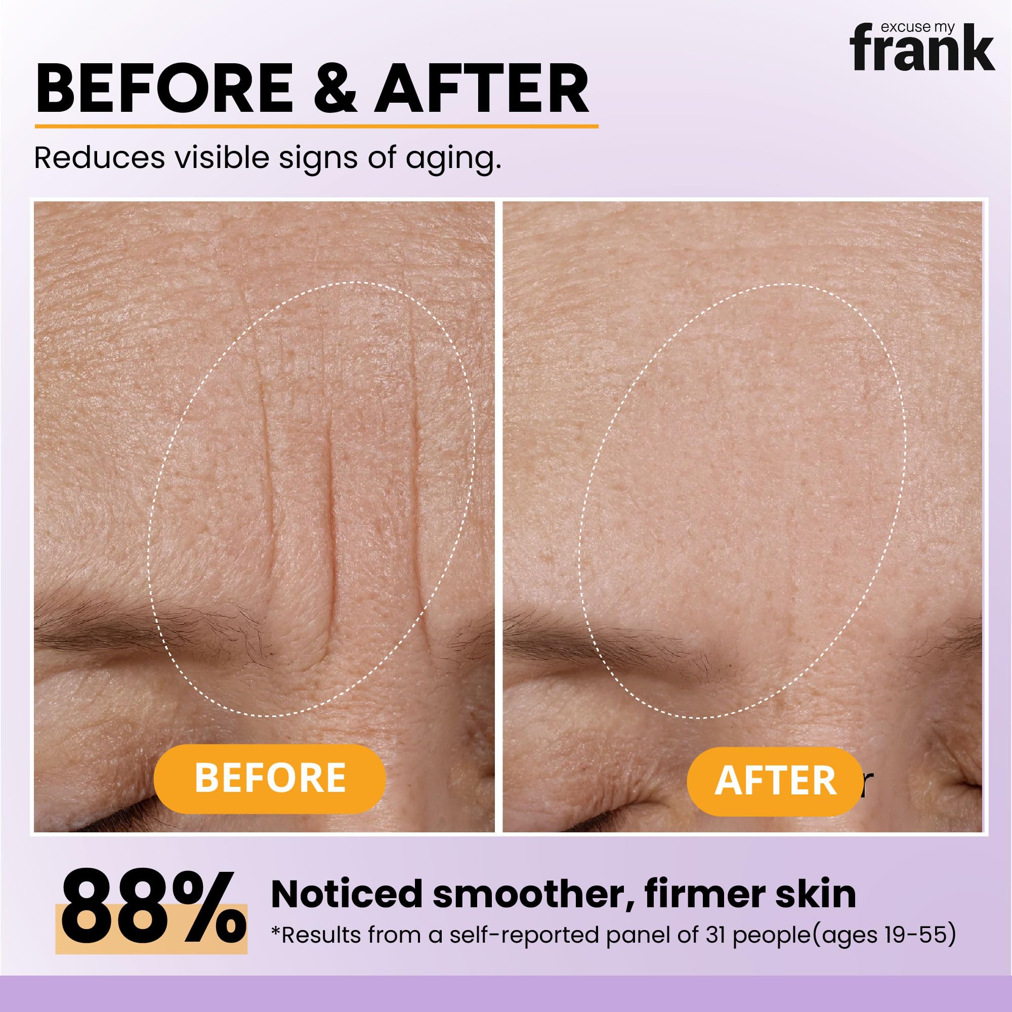 Excuse My Frank - Bakuchiol Age Defense Serum, for Smoothing Fine Lines and Wrinkles, Anti Aging, Hydrating Plump Cream (80ml, 2.7fl. oz.) (1 Pack)