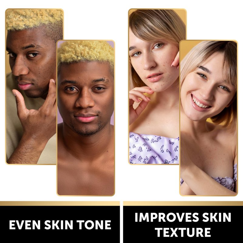 VALITIC Kojic Acid Soap - Turmeric Soap for Dark Spots for Face and Body - Exfoliating Bar for Hyperpigmentation, Skin Tone Corrector with Retinol, Vitamin C, Collagen and Hyaluronic Acid - 2 Pack