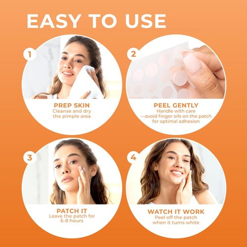 PatchRx Pimple Patches for Face (240 Patches), Hydrocolloid Acne Patches, Pimple Patch Pimple Stickers, Hydrocolloid Patch Acne Dots Acne Pimple Patches For Face, Zit Patches, Acne Spot