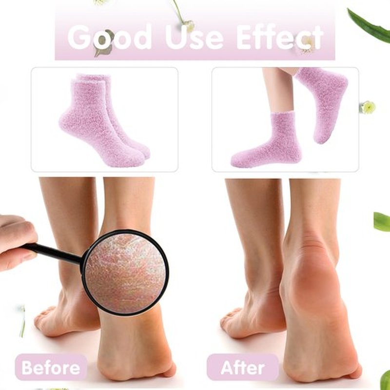 3 Pairs Aloe Moisturizing Socks for Dry Cracked Feet, Sleeping Fuzzy Non-Slip Lotion Socks for Women Men Spa, Foot Care for Repairing Softening Dry Cracked Heel