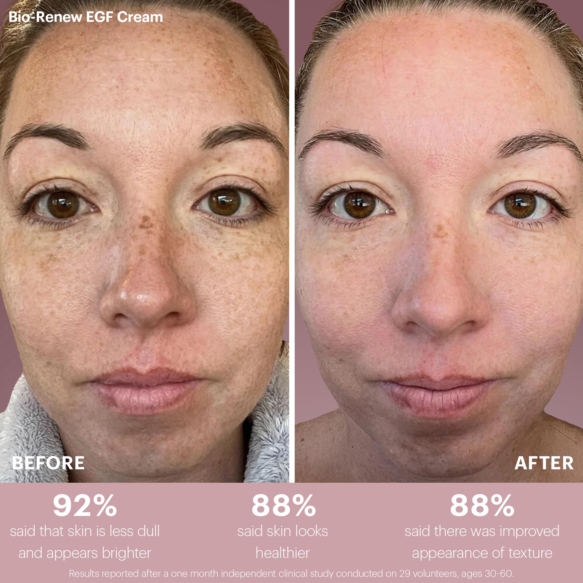 Glo Skin Beauty Bio-Renew EGF Discovery Set ($196 Value) – Travel Size Anti-Aging Skincare Kit for Hydration, Smoothing & Skin Renewal