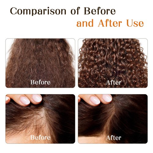 LABJD Batana Oil for Hair Growth, Natural Hair Growth Oil & Hair Care Solution for Stronger, Thicker Hair - Stimulates Regrowth, Nourishes & Repairs Damage, 2 Pack