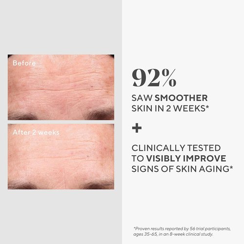 Murad Retinol Youth Renewal Serum - Fast-Acting Anti-Aging Treatment with Hyaluronic Acid - 1 oz