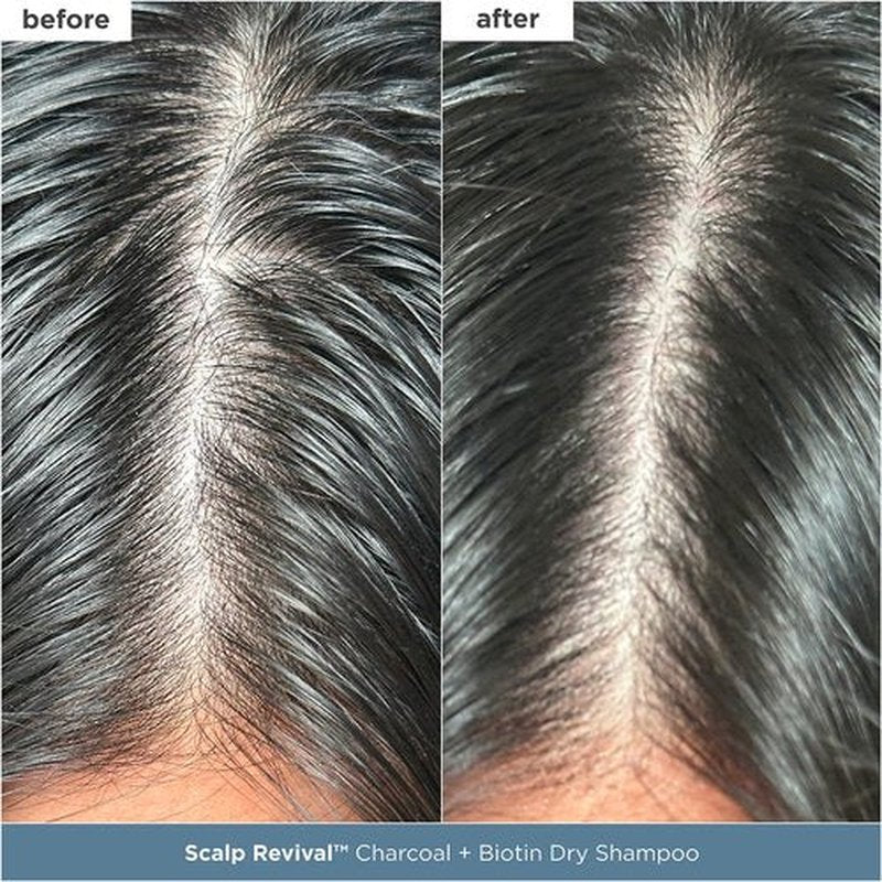 Briogeo Scalp Revival Essentials Set - Detox & Hydrate Your Scalp with Charcoal & Tea Tree | Vegan & Cruelty-Free