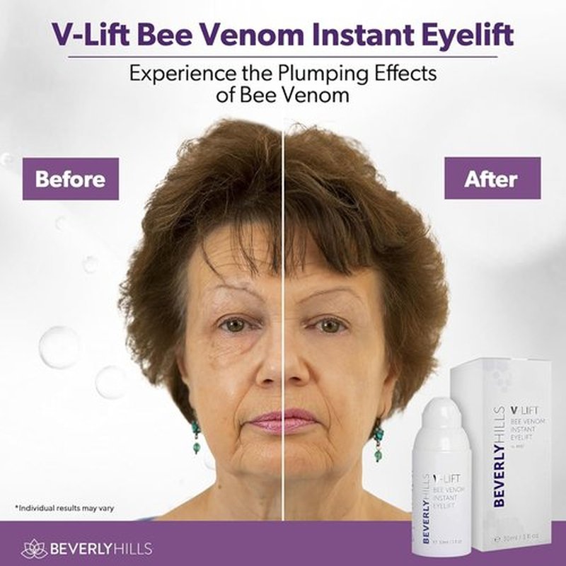 Beverly Hills V-Lift Eye Serum - Instant Eye Lift & Tuck with Bee Venom for Dark Circles | 30mL (120 Day Supply)