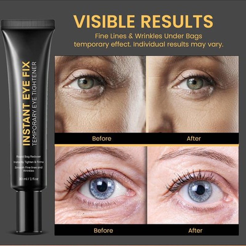 Foffreo Temporary Instant Under Eye Tightener: Reduces Under-Eye Bags, Dark Circles, Puffiness, Wrinkles Advanced Firming Polysaccharide Formula 30 ml