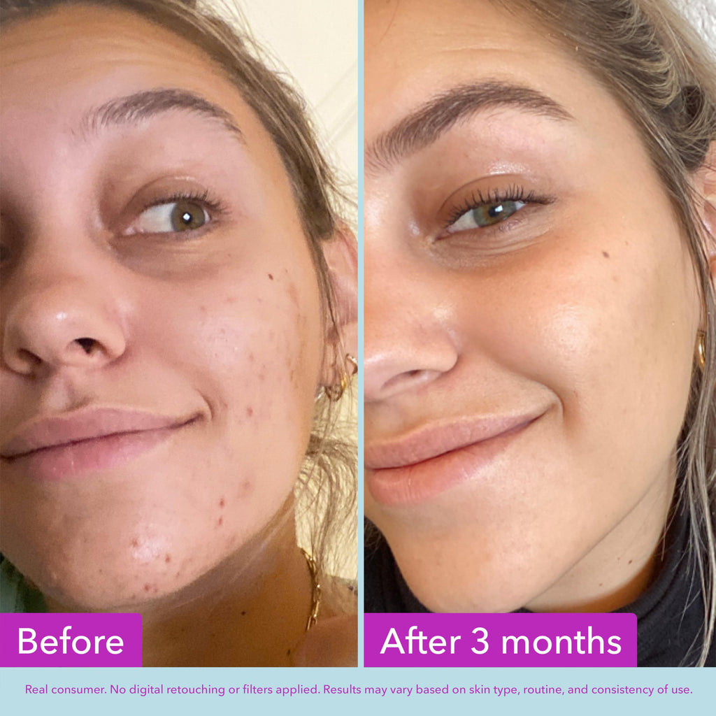Good Molecules Niacinamide Brightening Toner - Toner for Face with Niacinamide and Arbutin for Skin Tone Balancing - Minimizes the Look of Pores, Facial Skin Care