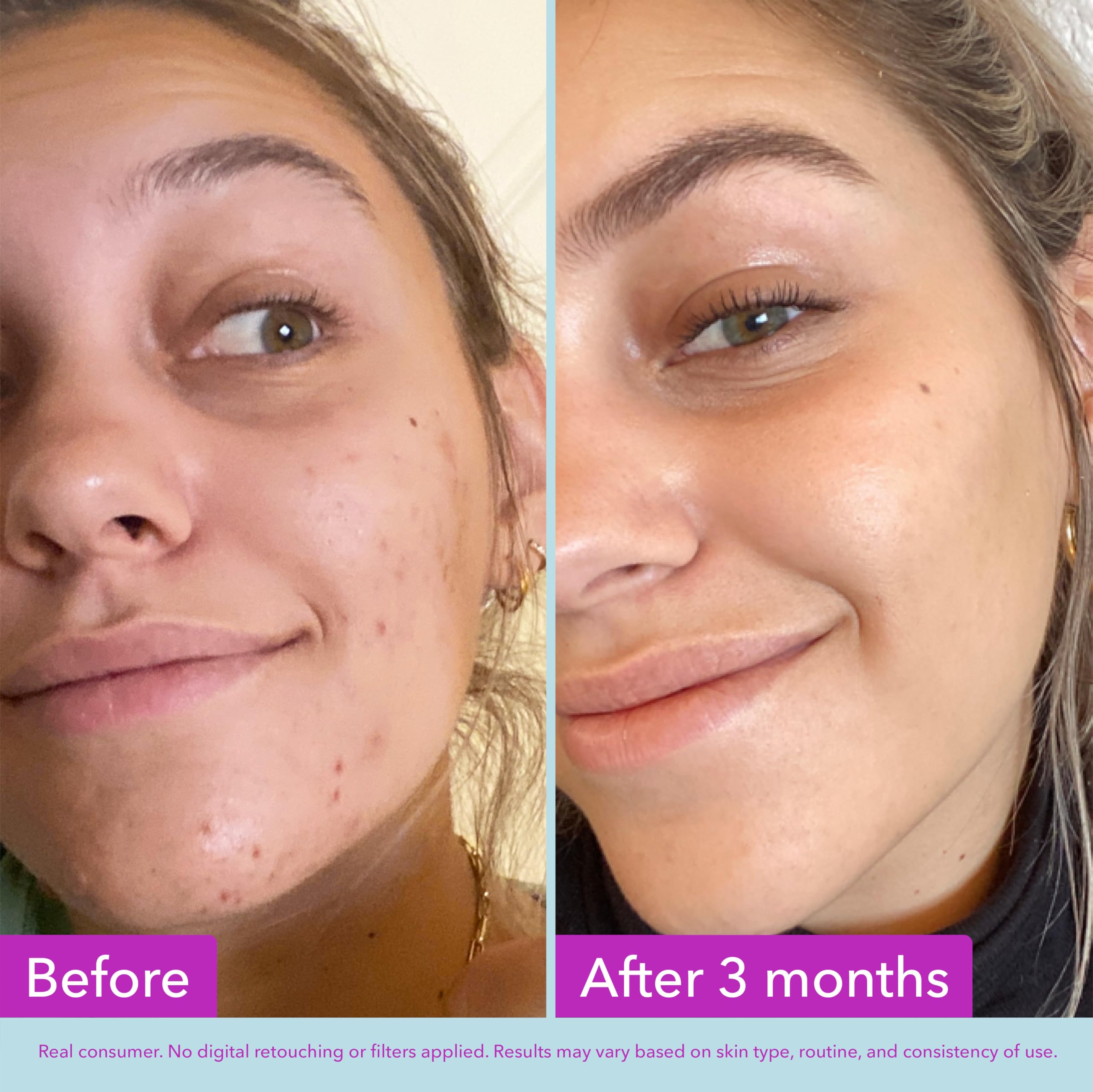 Good Molecules Niacinamide Brightening Toner - Toner for Face with Niacinamide and Arbutin for Skin Tone Balancing - Minimizes the Look of Pores, Facial Skin Care