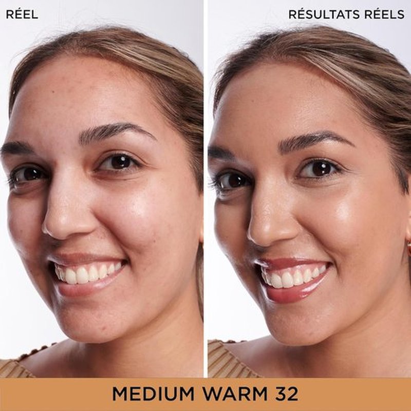 IT Cosmetics Bye Bye Dark Spots Concealer | Brightening Serum with 2% Niacinamide & Hyaluronic Acid - Medium Coverage, Natural Finish - 0.22 fl oz