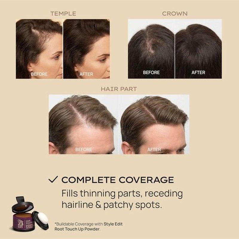 Style Edit Hair Building Fibers - Conceal Thinning Hair & Bald Spots | 100% Plant-Based, Dark Brown 0.88oz