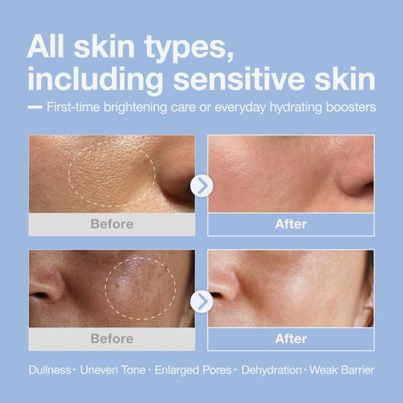 Cosyuree Niacinamide + Hyaluronic Brightening Deep Dive Serum,10% Brightening Complex, Deep Hydration Glow & Smooth Texture, Fragrance-Free, 30ml(1.01 fl oz)