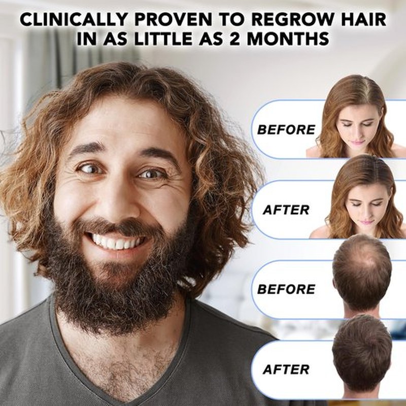 Minoxidil for Men-5% Extra Strength Hair Regrowth for Men Treatment-5% Topical Solution-Dropper Applicator Included -Minoxidil for Women-Stop Thinning & Hair Loss (1pcs