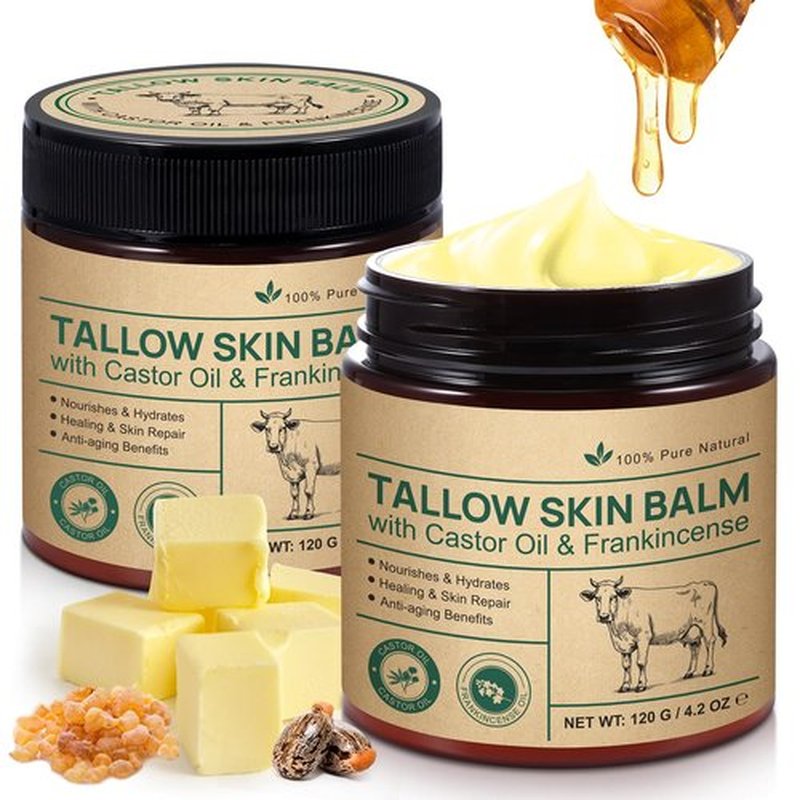 Alstaky Beef Tallow Skin Care with Castor Oi & Frankincenses, Grass Fed Whipped Tallow Honey Balm for Face & Body, Natural Moisturizer Hydrates, Deeply Nourishes, Enhances Natural Radiance 120g