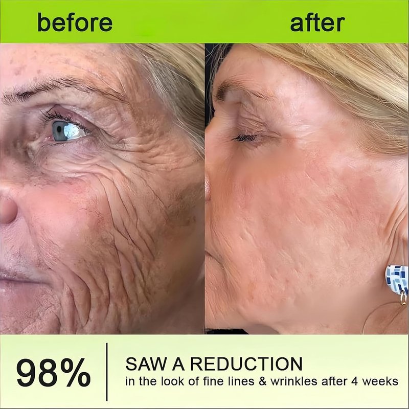 Botoxmix Wrinkle-Lift Tightening Cream - Anti-Aging Retinol Shot for Fine Lines & Pore Minimizing (2 PCS)