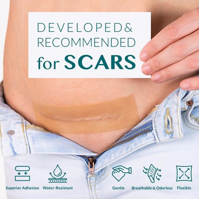 Silicone Scar Tape, Silicone Scar Sheets, Scar Tape for Surgical Scars, Silicone Tape for Scars, Scar Sheets for Surgical Scars, C-Section, Tummy Tuck and Keloid (1.6"x 60" Roll-1.5M)