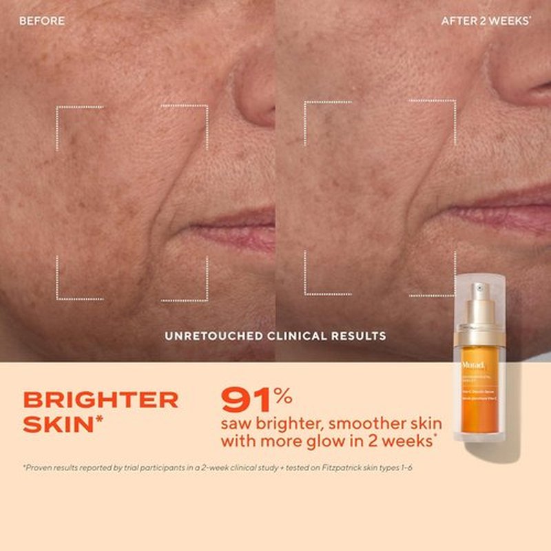 Murad Brighten Trial Kit - Vitamin C Skincare Set for Radiant, Even-Toned Skin | Travel-Friendly
