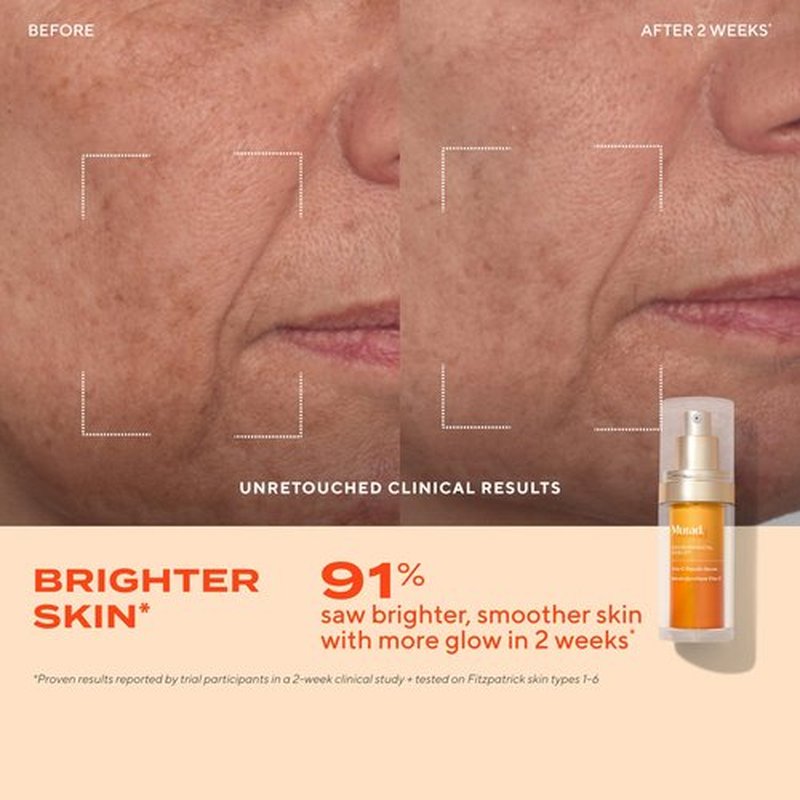 Murad Brighten Trial Kit – Vitamin C Skincare Set for Brighten & Even Tone - Travel-Friendly Kit for Radiant, Even-Toned Skin (3-Piece Glow Better Kit)