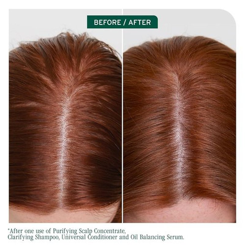 Biolage Scalp Sync Shampoo & Conditioner Set - Clarifying, Paraben-Free, Vegan | 33.8 Fl Oz for Oily Hair