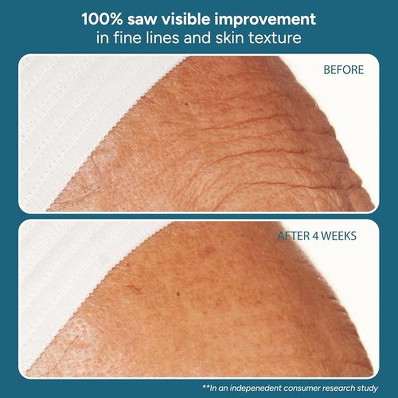 Lancer Skincare The Method - Nourishing Anti-Aging Moisturizer with Hyaluronic Acid | For Normal/Combination Skin